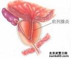 富锦北大泌尿肛肠医院成功治愈多年不孕