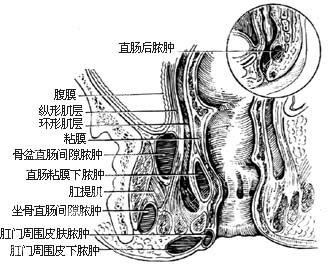 肛门瘙痒
