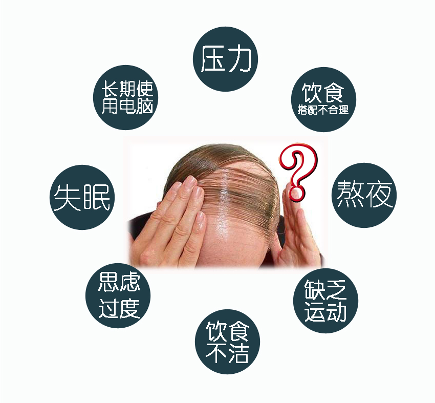 脱发