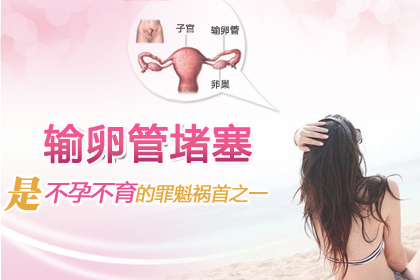 输卵管不孕