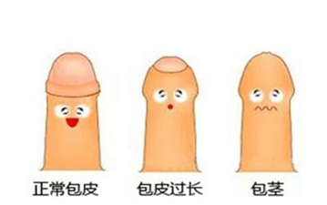 包皮过长